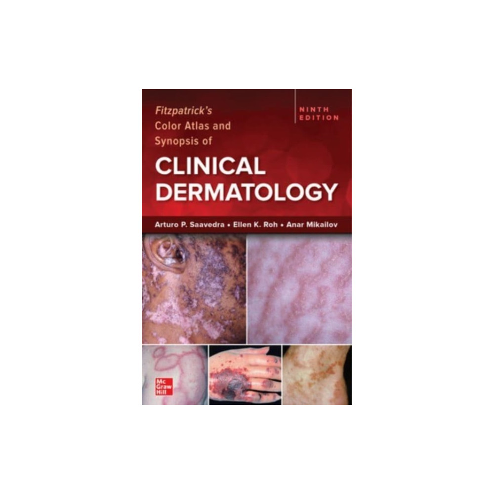 Fitzpatrick's Color Atlas and Synopsis of Clinical Dermatology, Ninth Edition (häftad, english) McGraw-Hill Education