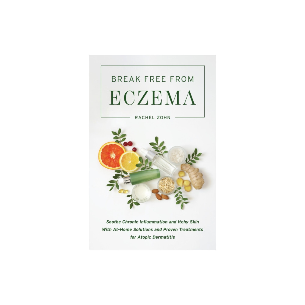 Break Free From Eczema (häftad, english) Ulysses Press