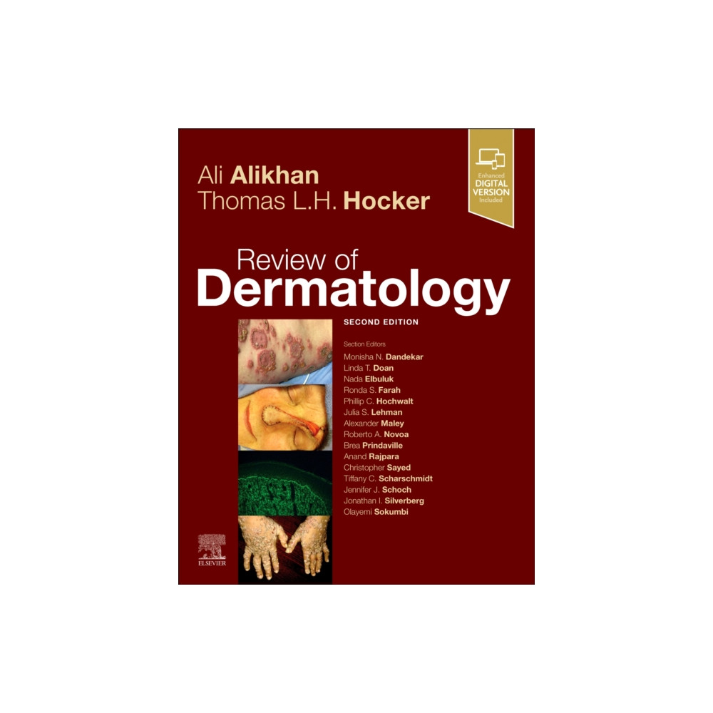 Review of Dermatology (häftad, english) Elsevier - Health Sciences Division