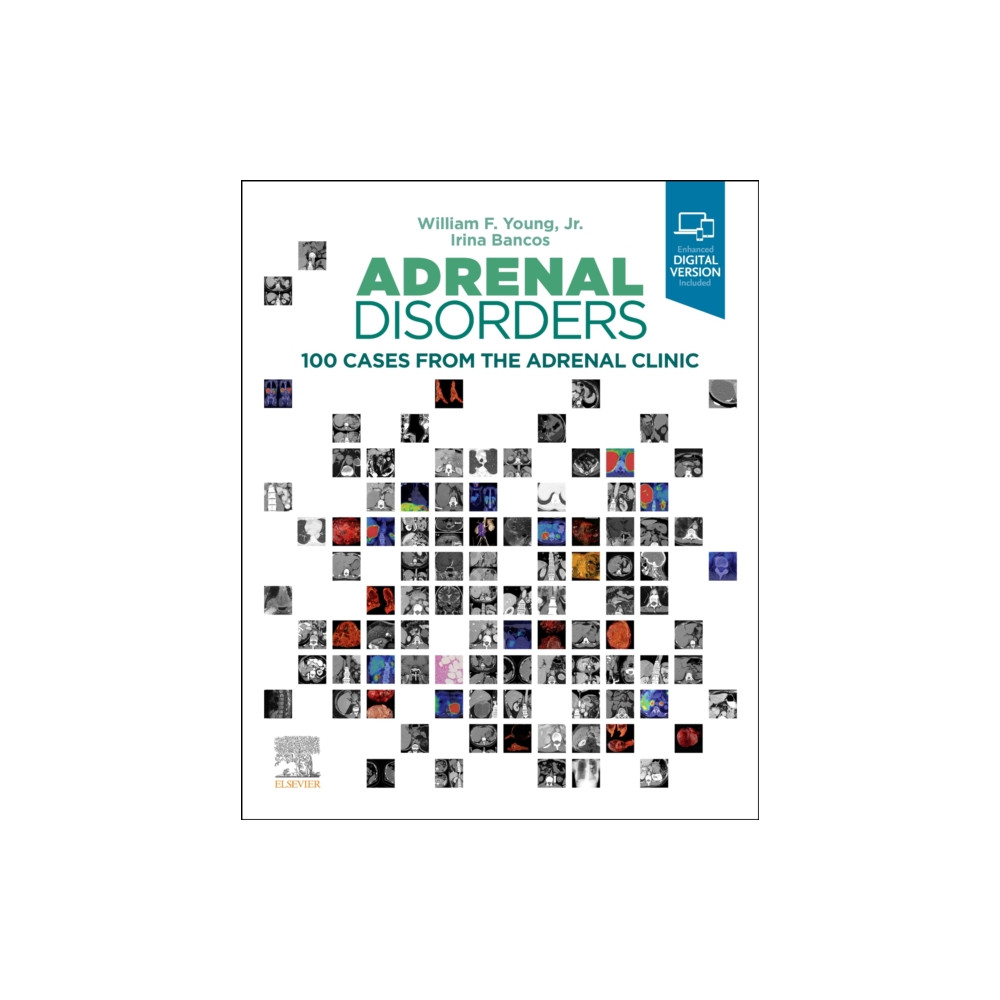 Adrenal Disorders (inbunden, english) Elsevier - Health Sciences Division