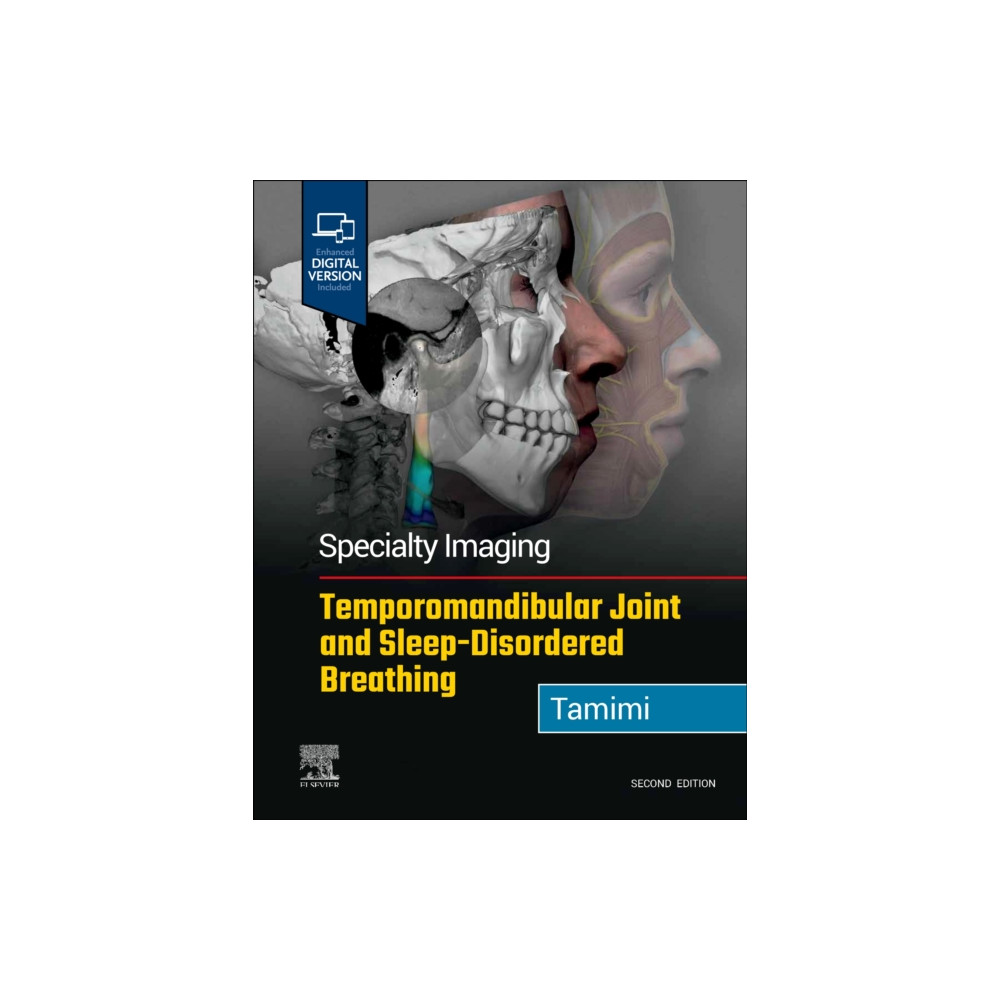 Specialty Imaging: Temporomandibular Joint and Sleep-Disordered Breathing (inbunden, english) Elsevier - Health Sciences Division