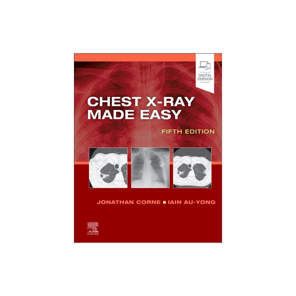 Chest X-Ray Made Easy (häftad, english) Elsevier Health Sciences