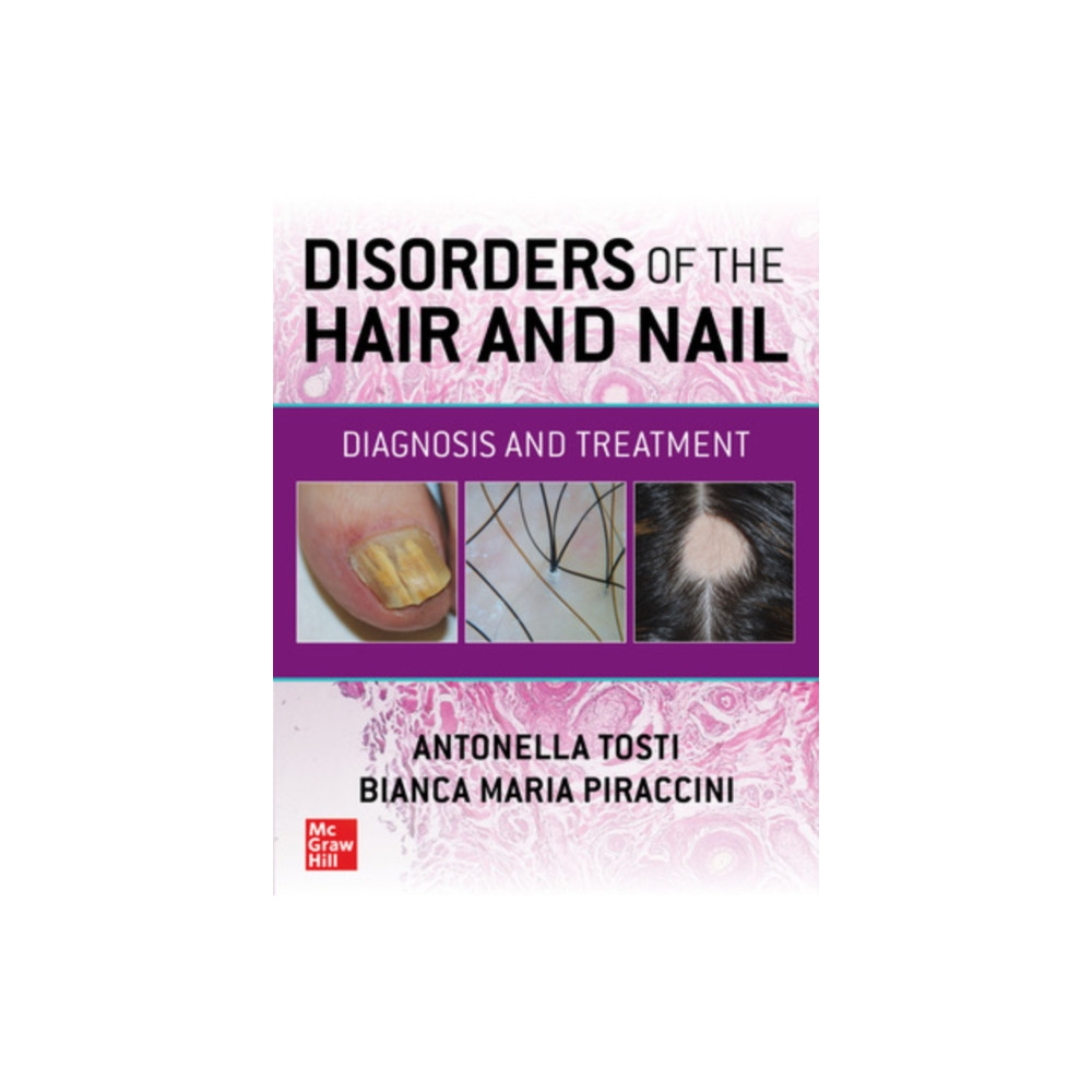 Disorders of the Hair and Nail: Diagnosis and Treatment (häftad, english) McGraw-Hill Education