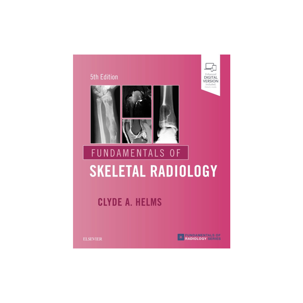 Fundamentals of Skeletal Radiology (häftad, english) Elsevier - Health Sciences Division