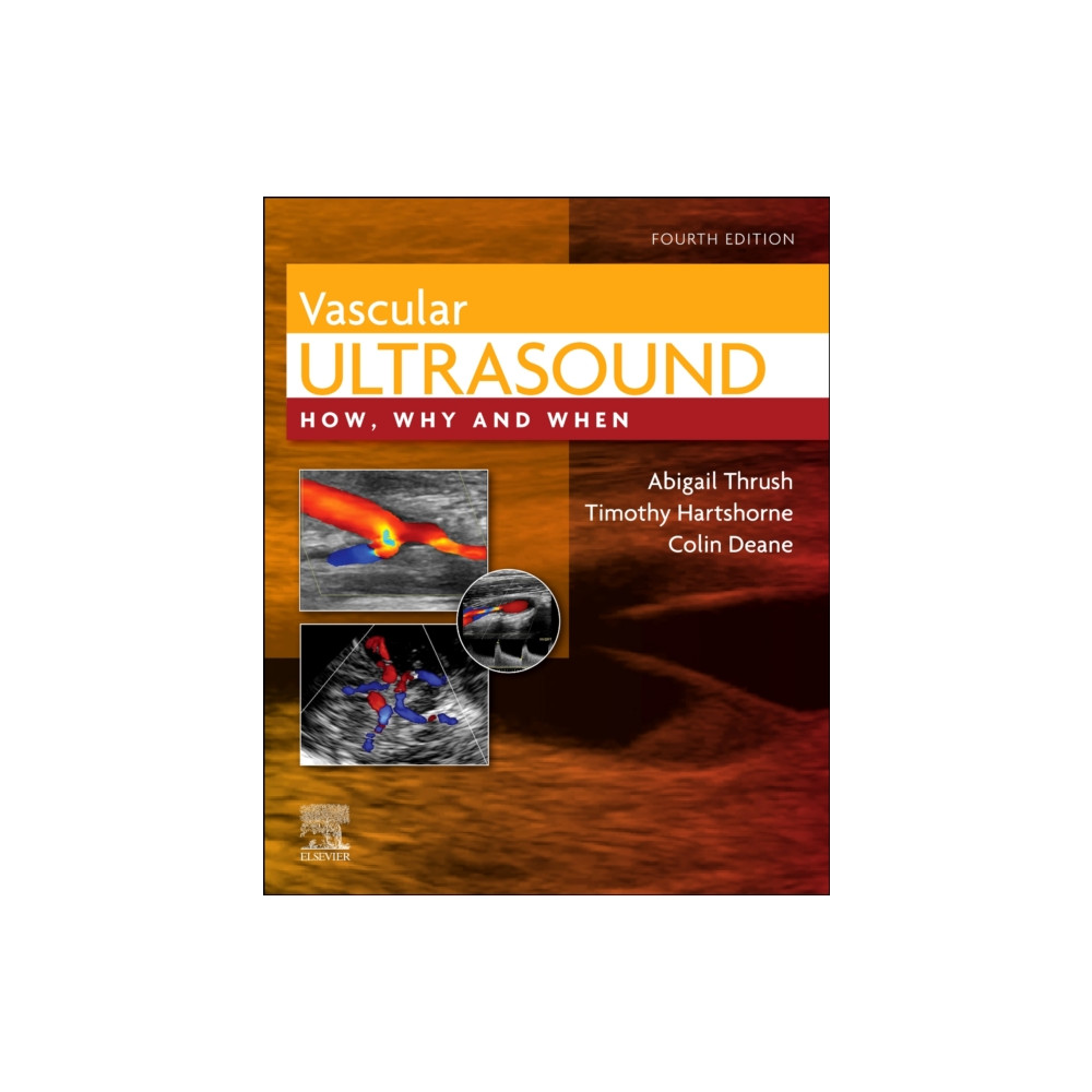 Vascular Ultrasound (inbunden, english) Elsevier Health Sciences