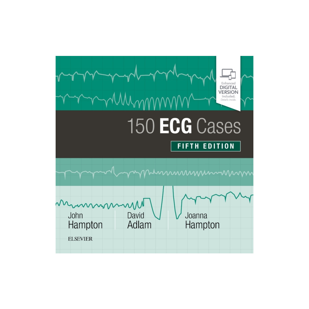 150 ECG Cases (häftad, english) Elsevier Health Sciences
