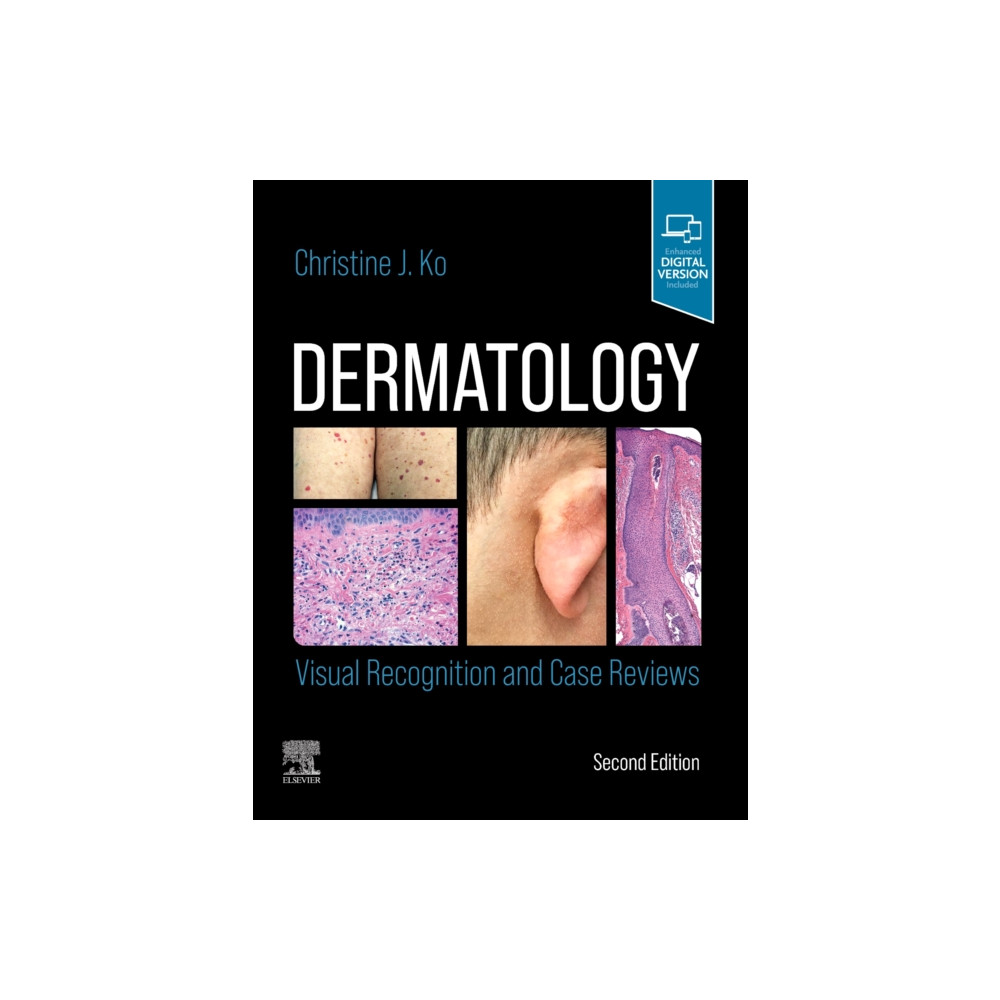 Dermatology: Visual Recognition and Case Reviews (häftad, english) Elsevier - Health Sciences Division