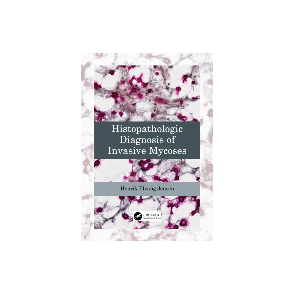 Histopathologic Diagnosis of Invasive Mycoses (häftad, english) Taylor & francis ltd