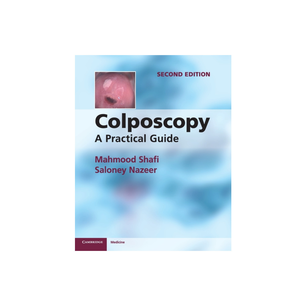 Colposcopy (häftad, english) Cambridge University Press