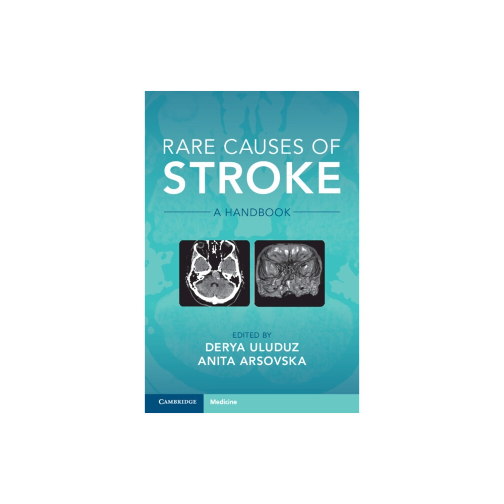 Rare Causes of Stroke (häftad, english) Cambridge University Press