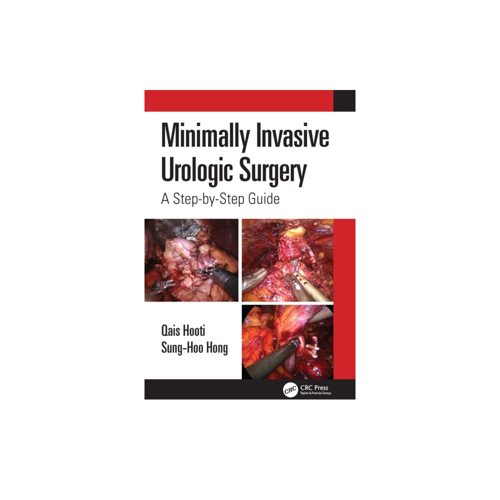 Minimally Invasive Urologic Surgery (häftad, english) Taylor & francis ltd