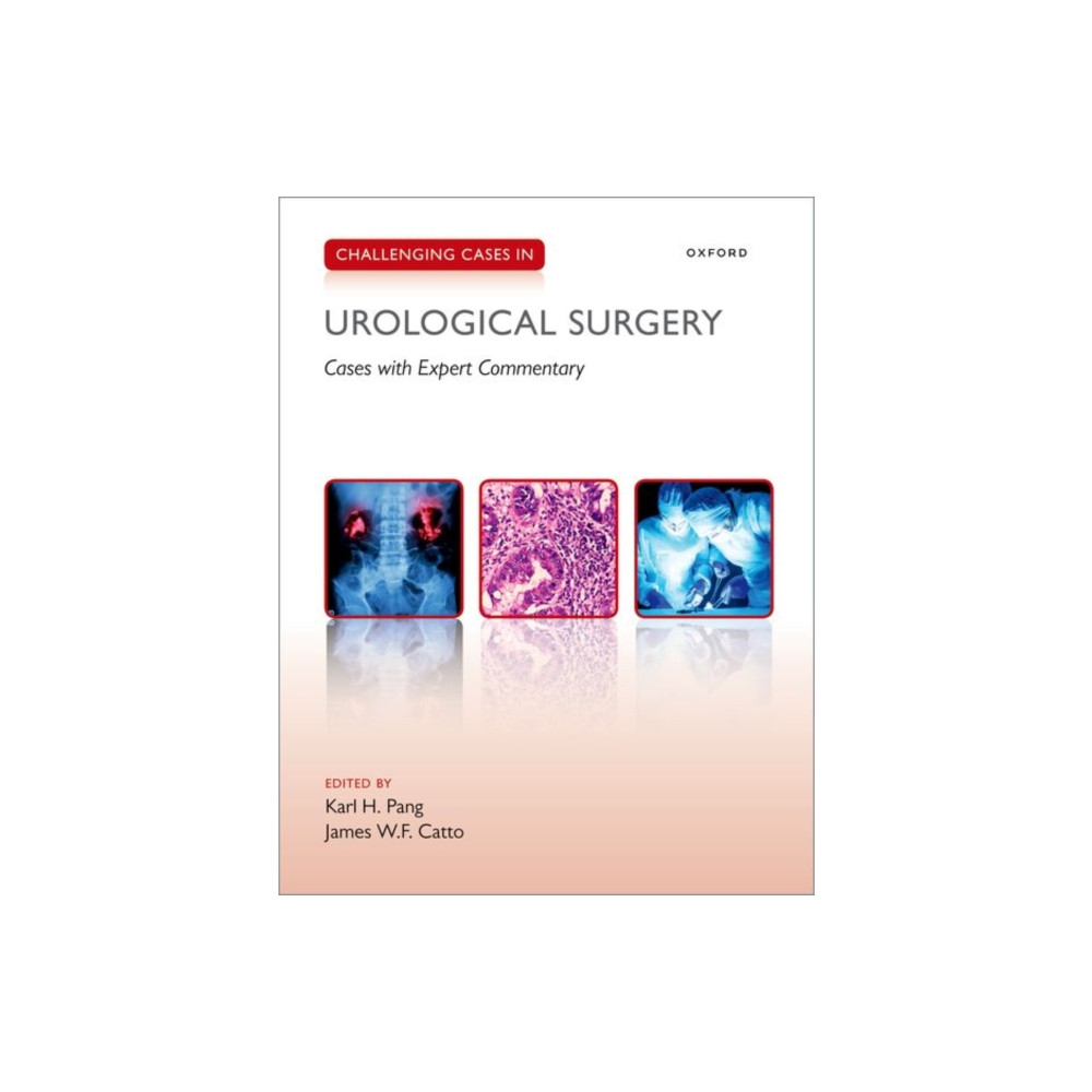 Challenging Cases in Urological Surgery (häftad, english) Oxford University Press