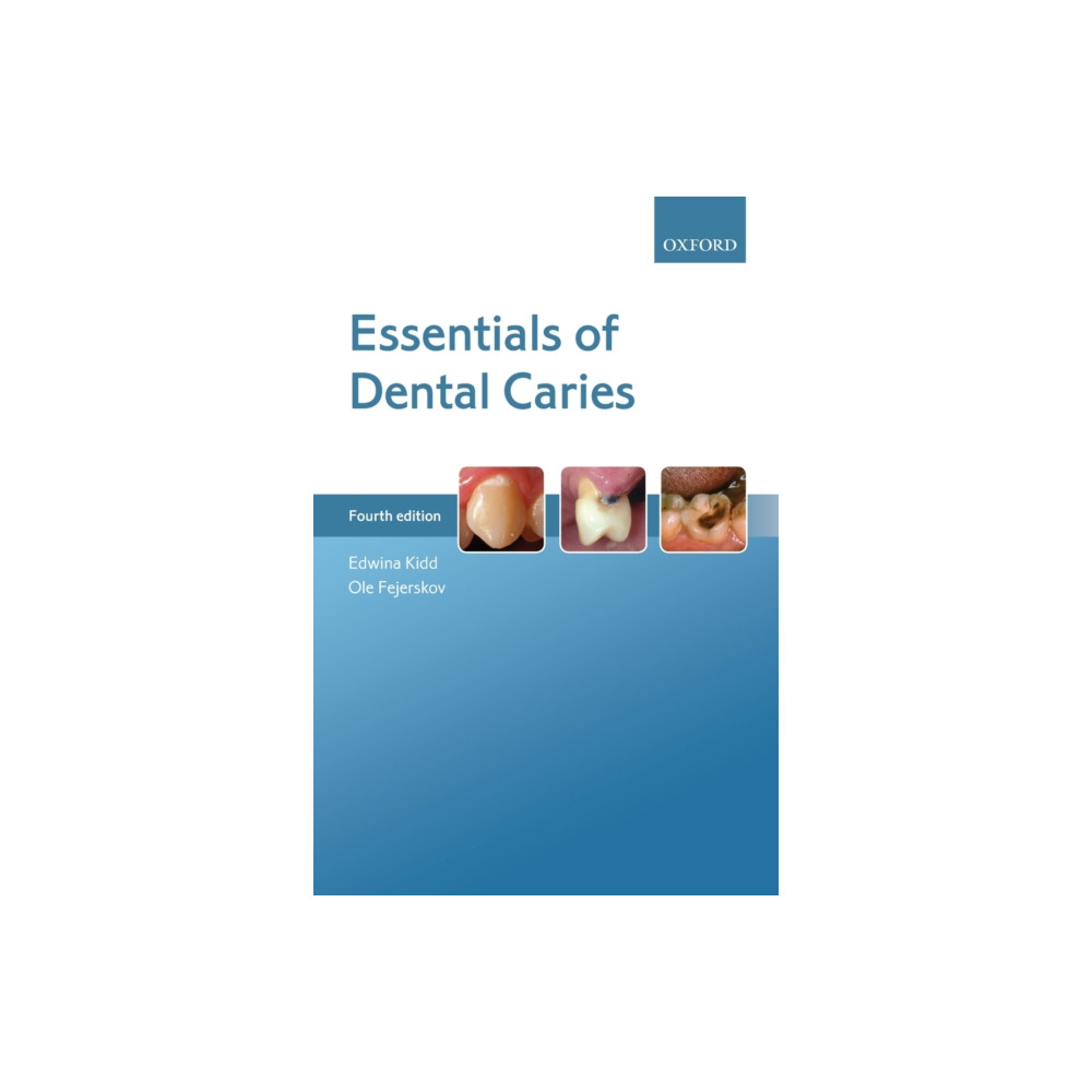 Essentials of Dental Caries (häftad, english) Oxford University Press