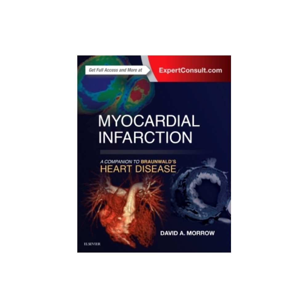 Myocardial Infarction: A Companion to Braunwald's Heart Disease (inbunden, english) Elsevier - Health Sciences Division