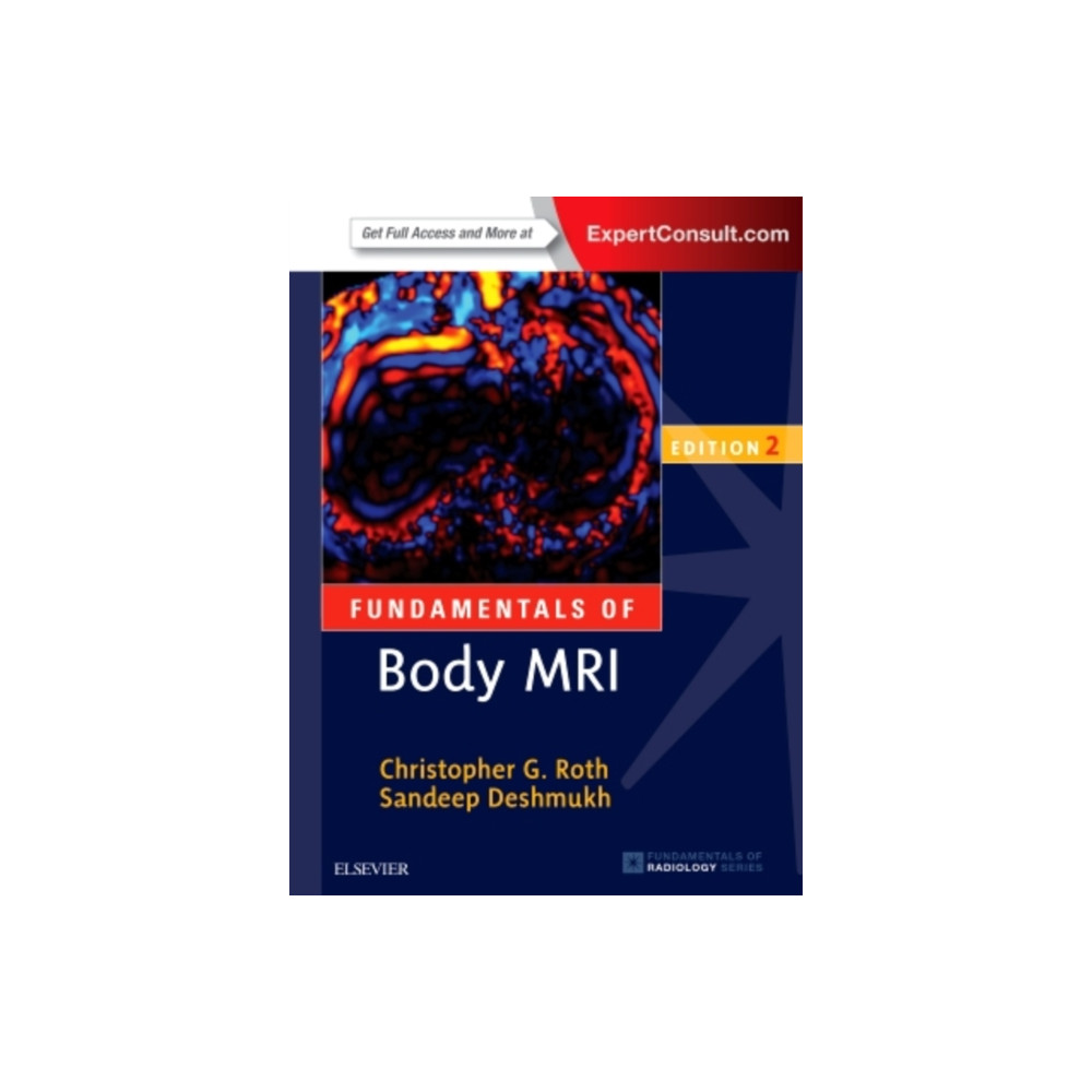 Fundamentals of Body MRI (häftad, english) Elsevier - Health Sciences Division