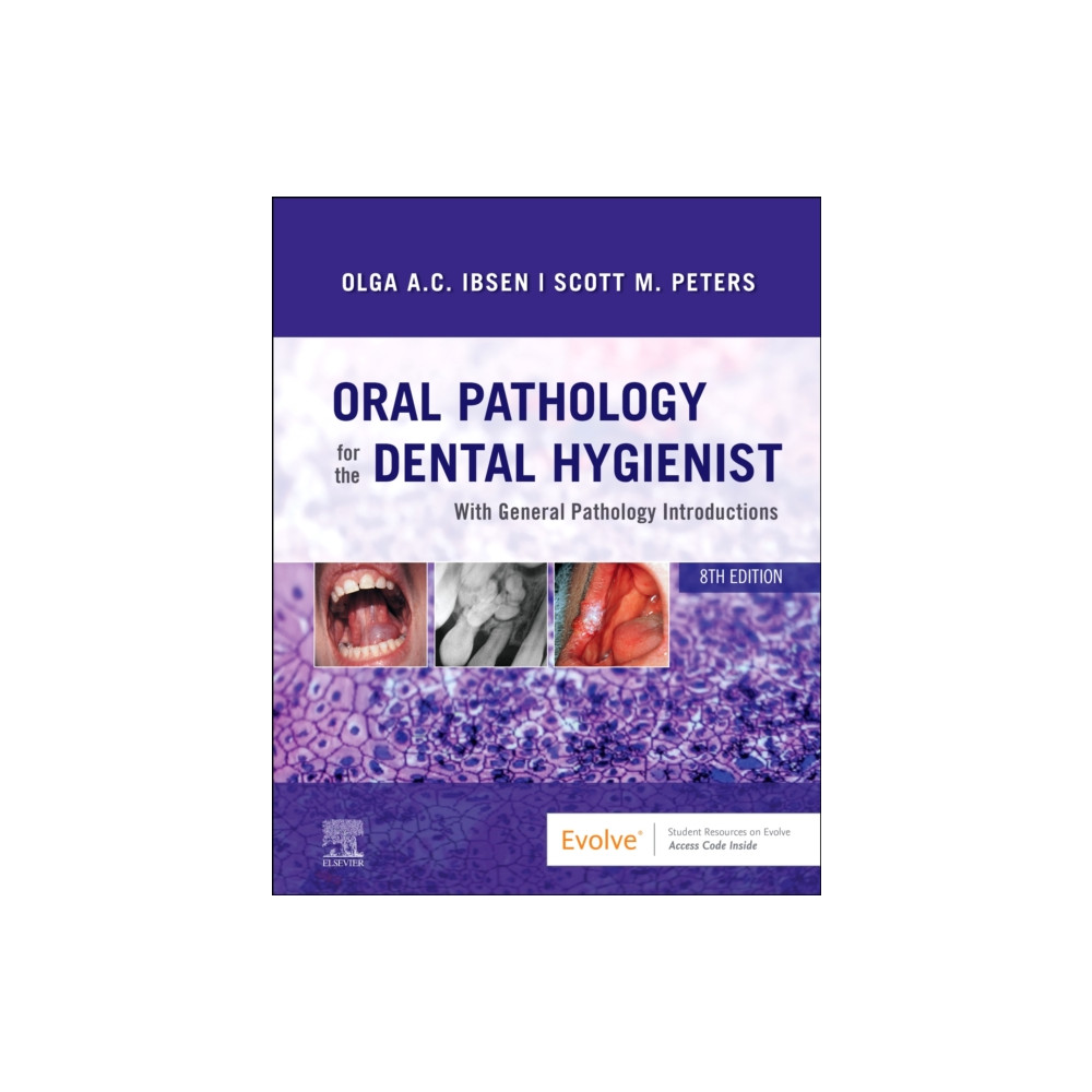 Oral Pathology for the Dental Hygienist (inbunden, english) Elsevier - Health Sciences Division