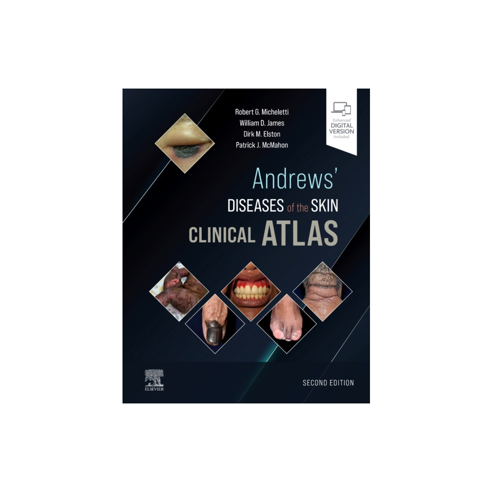Andrews' Diseases of the Skin Clinical Atlas (inbunden, english) Elsevier - Health Sciences Division